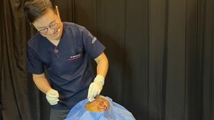 Tips Peremajaan Wajah dengan Kombinasi Filler HA dan Threadlift dari Pakar Estetika Korea, Dr Ho Sung Choi